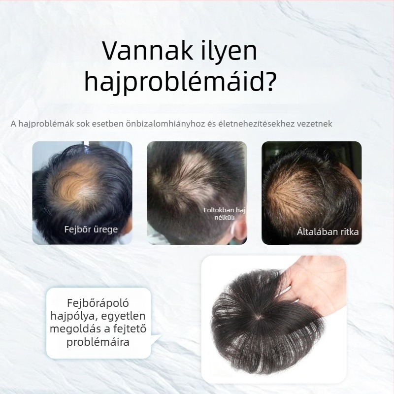 Fejtetői paróka - valódi emberi haj, egyenes haj, sima fedés heg és hajhullás ellen (nem festhető vagy vasalható)