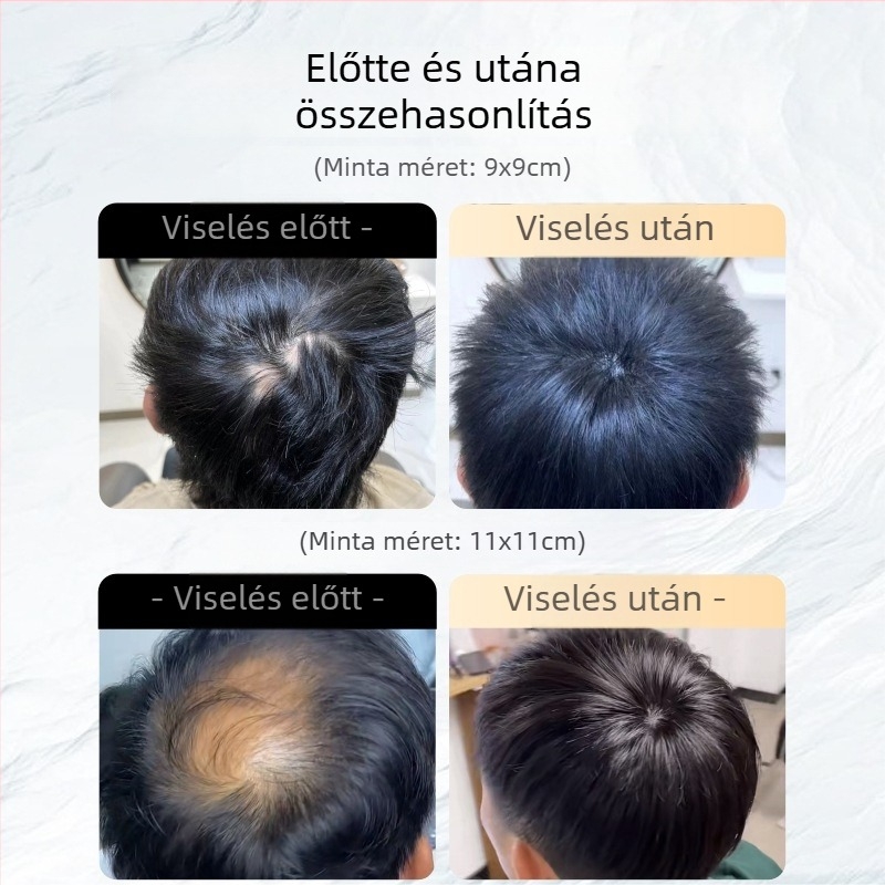 Fejtetői paróka - valódi emberi haj, egyenes haj, sima fedés heg és hajhullás ellen (nem festhető vagy vasalható)