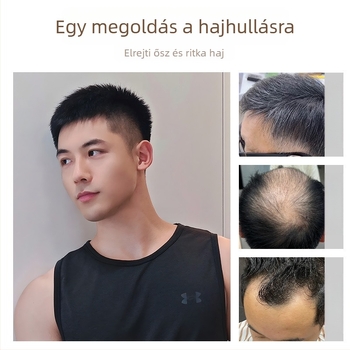 Férfi hajpótlás, egyenes haj, valódi emberi haj, festés és dauer megengedett, mechanizmus kivitel