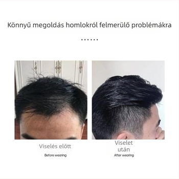 Hengyang Férfiaknak szóló homlok-pótló patch – kézzel szövött, valódi hajból