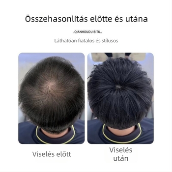 Férfi paróka-darab teljes valódi hajból, fehér haj fedése, fejbőrön lévő hegek és kopasz foltok elfedése, egyenes haj, hosszúság 15 cm vagy 8 cm