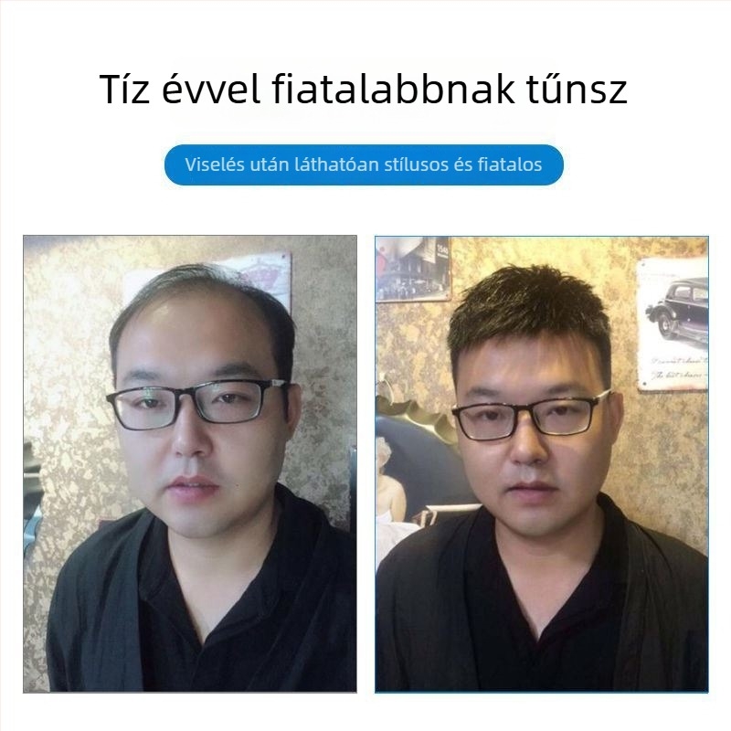 Férfi rövid hajú paróka valódi hajból, varrat nélküli, láthatatlan, elegáns megjelenés, koronán növeli a volument