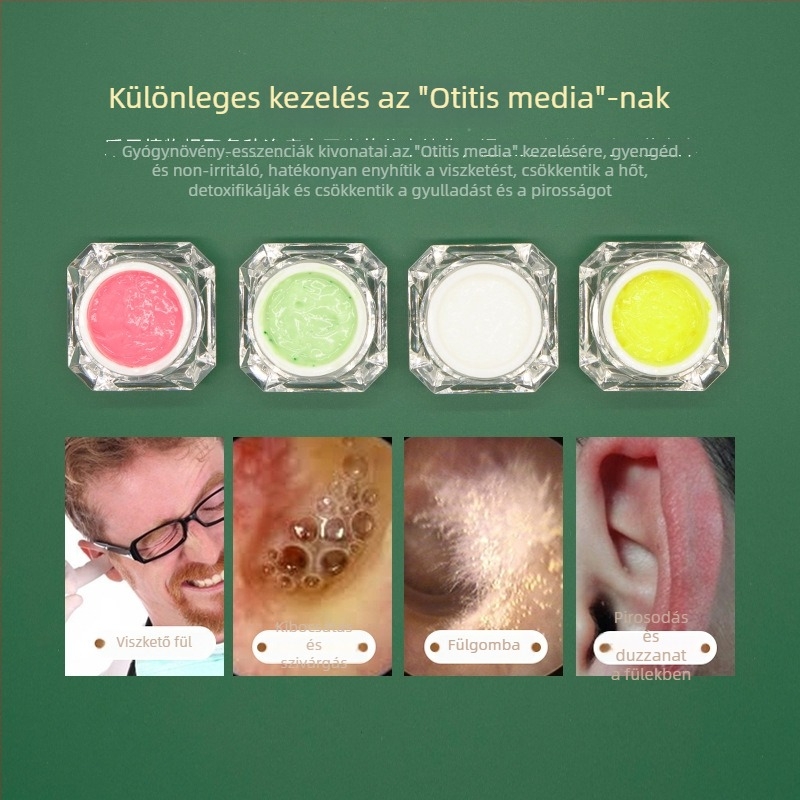 Fülápolási készlet: nem világító fülkanál és ápoló krém, vörösség és viszketés enyhítés, 10–20 g