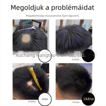 Biológiai fejbőr hegplaszt patch – emberi haj, kézzel szőtt, festhető