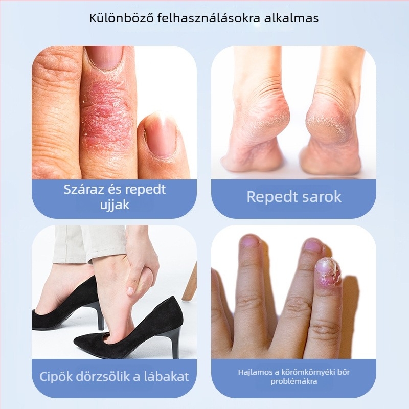 Ragasztó tapaszok száraz, repedt kezekhez és lábakhoz