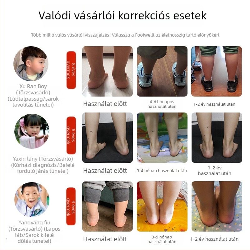 Gyerekeknek tervezett laposlábu cipő valgus-korrigálóval és X-formájú láb járásának korrigálására