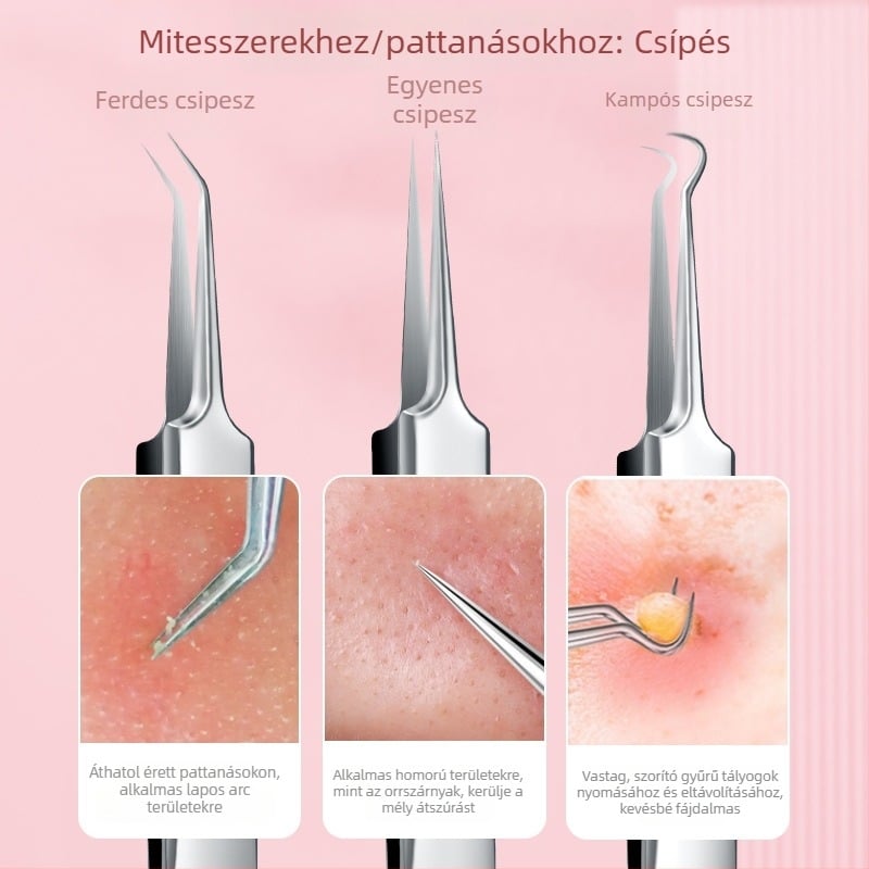 Rozsdamentes acélból készült mitesszer-eltávolító készlet: aknecsipeszek és akné tűk
