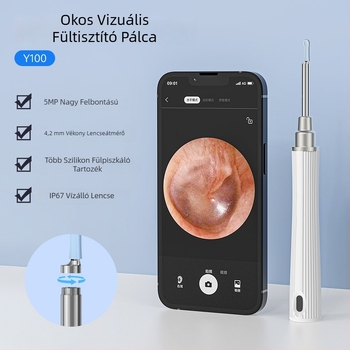 Új vizuális fülkanál HD kamerával és Wi‑Fi endoszkóppal