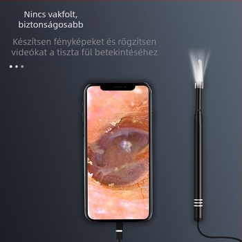 Új intelligens vizuális fül-endoszkóp, 5,5 mm átmérőjű, három az egyben, otthoni használatra.