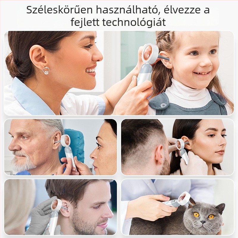 Kézi fülcsatorna detektor kijelzővel, fül-orr-gégészeti endoszkóp, mandulakövek detektálása, hordozható