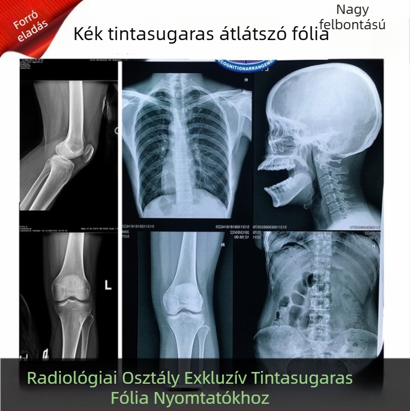 Fogorvosi röntgenfilm száraz radiológiai nyomtatáshoz – kék alappal, inkjet DR/CR/CT