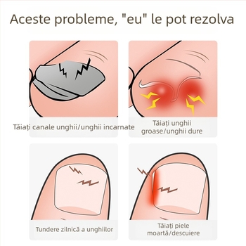 Unghiere noi, foarfece speciale pentru unghii, extensie oblică a gurii, clește Hawkbill single, unghii încarnate, inflamație pentru pedichiură, unghii clește