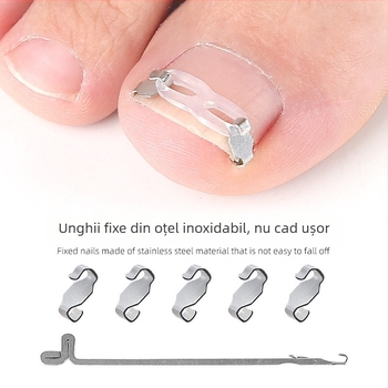 Dispozitiv ortopedic pentru unghii încarnate cu plasture de tracțiune pentru corectarea unghiilor încarnate