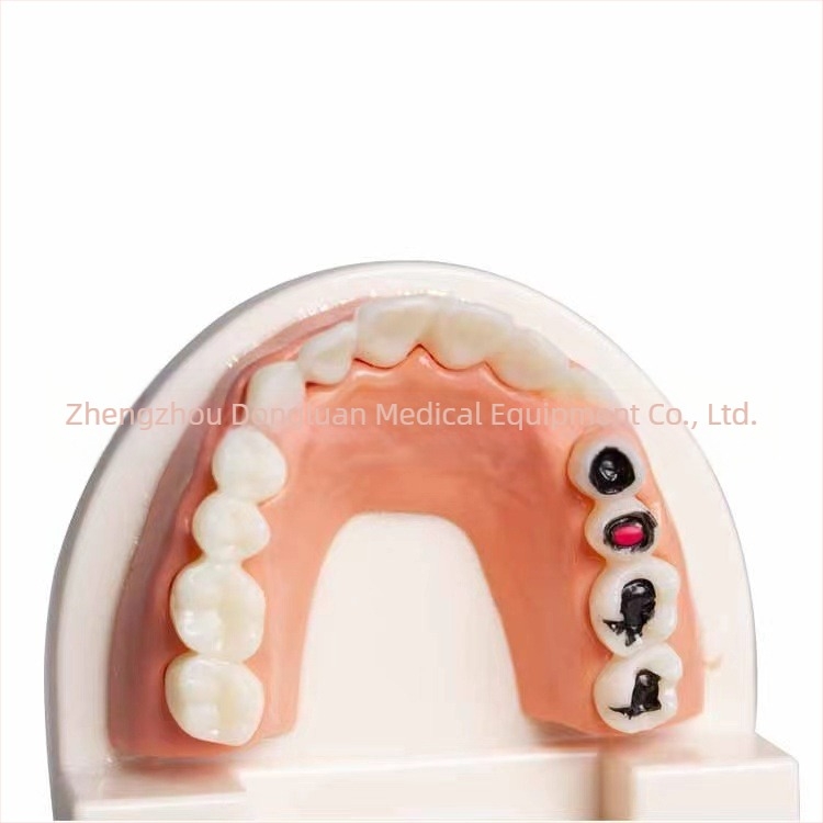 Shang Shang model dentar educațional pentru adulți, de unică folosință, 90 g, pachet de 100