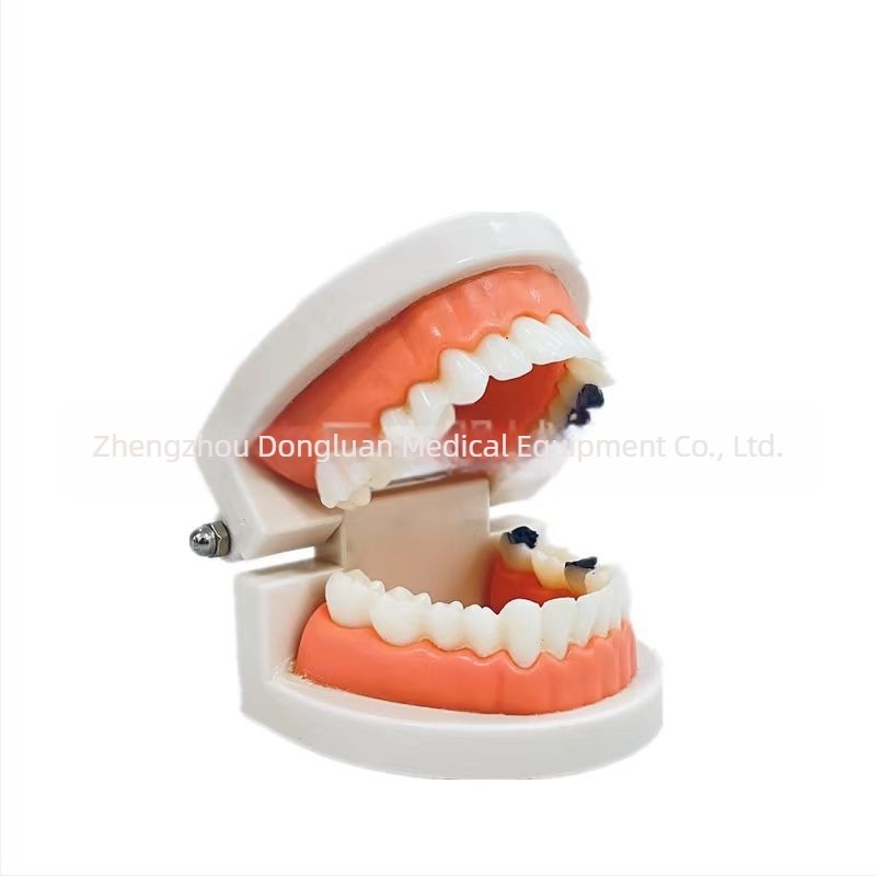 Shang Shang model dentar educațional pentru adulți, de unică folosință, 90 g, pachet de 100
