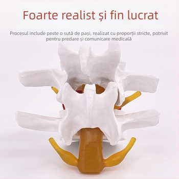 Model de coloană lombară pentru instruire medicală – demonstrație a comprimării discului lombar și patologie osoasă a coloanei vertebrale.