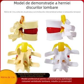 Model de disc intervertebral, PVC, model educațional de anatomie pentru demonstrarea patologiei coloanei lombare, Zhenghe River