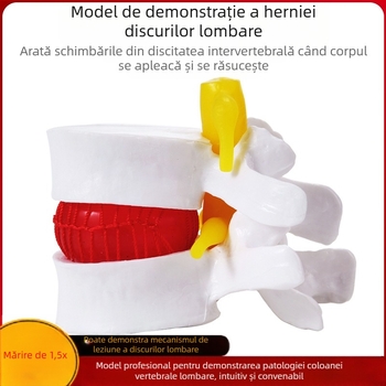Model de disc intervertebral, PVC, model educațional de anatomie pentru demonstrarea patologiei coloanei lombare, Zhenghe River