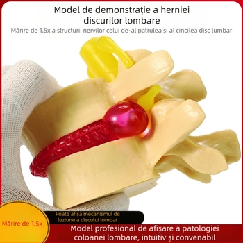 Model de disc intervertebral, PVC, model educațional de anatomie pentru demonstrarea patologiei coloanei lombare, Zhenghe River