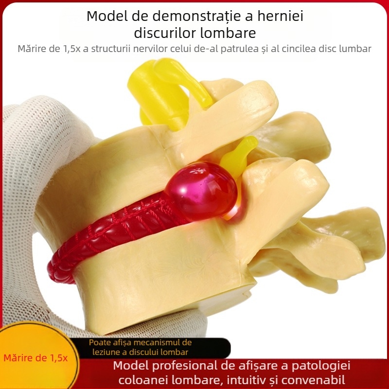Model de disc intervertebral, PVC, model educațional de anatomie pentru demonstrarea patologiei coloanei lombare, Zhenghe River