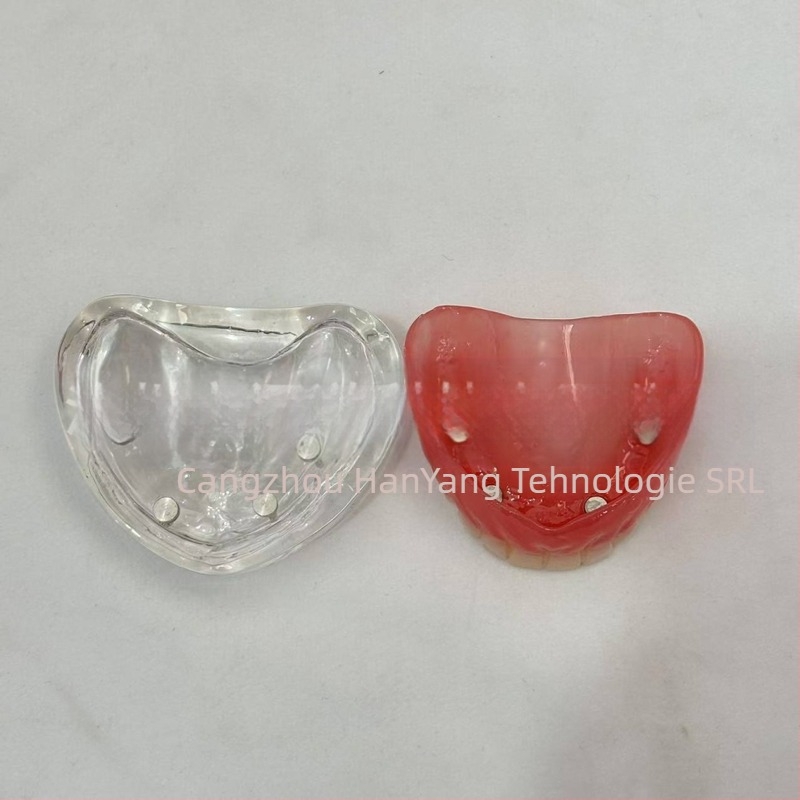 Model de implant dentar pentru practică – maxilar superior și inferior, jumătate de arcadă cu 2 sau 4 implanturi