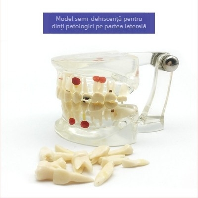 Model didactic stomatologic pentru patologie dentară și restaurare cu matriță standard de implant; marcă locală, siglă imprimată, destinat educației dentare