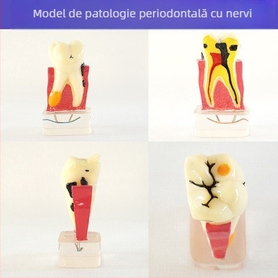 Model didactic stomatologic pentru patologie dentară și restaurare cu matriță standard de implant; marcă locală, siglă imprimată, destinat educației dentare