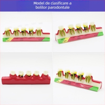 Model didactic stomatologic pentru patologie dentară și restaurare cu matriță standard de implant; marcă locală, siglă imprimată, destinat educației dentare