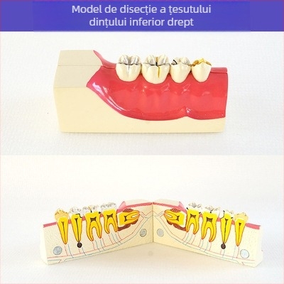 Model didactic stomatologic pentru patologie dentară și restaurare cu matriță standard de implant; marcă locală, siglă imprimată, destinat educației dentare