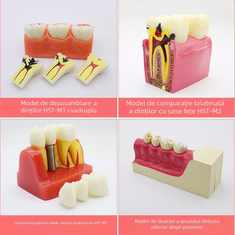 Model didactic stomatologic pentru patologie dentară și restaurare cu matriță standard de implant; marcă locală, siglă imprimată, destinat educației dentare