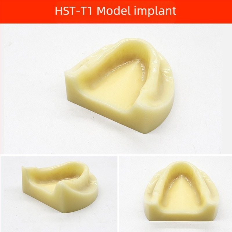 Model didactic stomatologic pentru patologie dentară și restaurare cu matriță standard de implant; marcă locală, siglă imprimată, destinat educației dentare