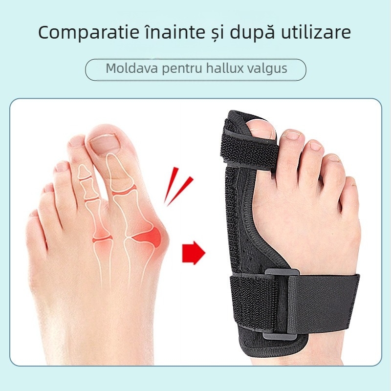 Separator unisex pentru hallux valgus cu sprijin pentru degetul mare – protecție, materiale: flanel, burete, Velcro, bandă din plastic; seria Separator; stil Hallux valgus; potrivit pentru toate anotimpurile
