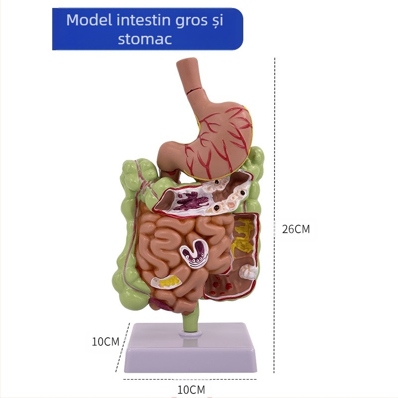 Model de anatomie a stomacului uman — secțiune coronară, model gastric patologic cu perforație, educație în gastroenterologie