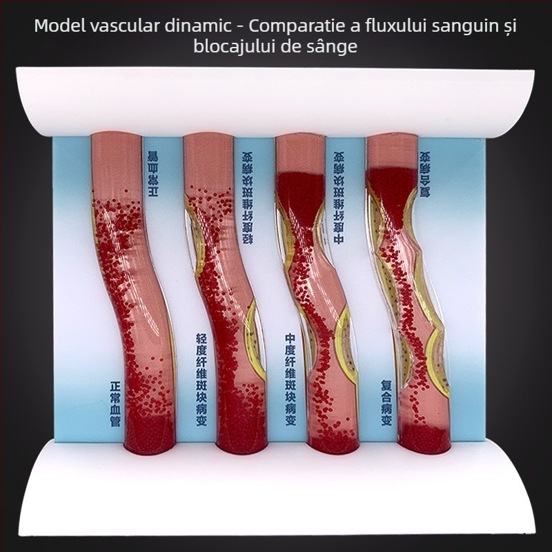 Model vascular dinamic – blocaj de densitate ridicată și tromb de placă – model educațional din plastic