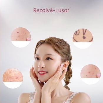 Creion pentru îndepărtarea alunițelor și petelor, pentru salon și uz casnic – dispozitiv laser pentru eliminarea petelor