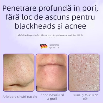 Instrument profesional de salon de înfrumusețare din oțel inoxidabil: clemă pentru acnee tip celulă, design delfin, origine Yangjiang, 5 ani de valabilitate