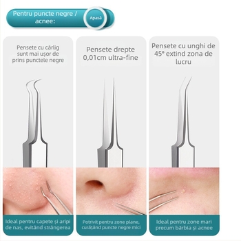 GECOMO Set de ace pentru acnee – oțel inoxidabil, ace ultra-ascuțite și pense ultra-fine pentru îndepărtarea punctelor negre și a comedoanelor închise