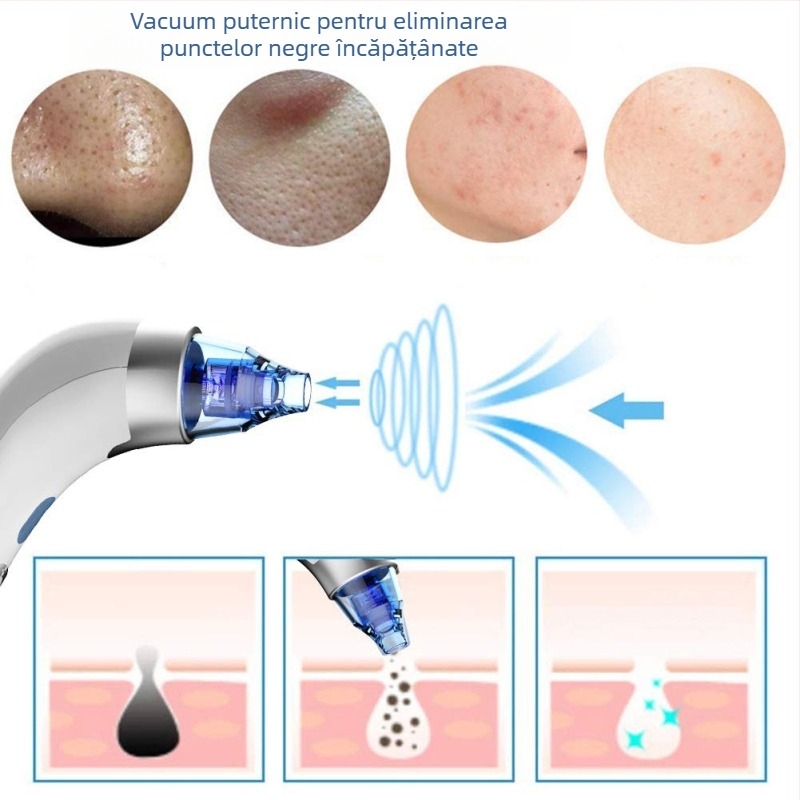 Dispozitiv de aspirare a punctelor negre pentru pori - rotație electrică, 4 capete, 5 trepte, carcasă ABS, terapie cu compresie caldă/rece