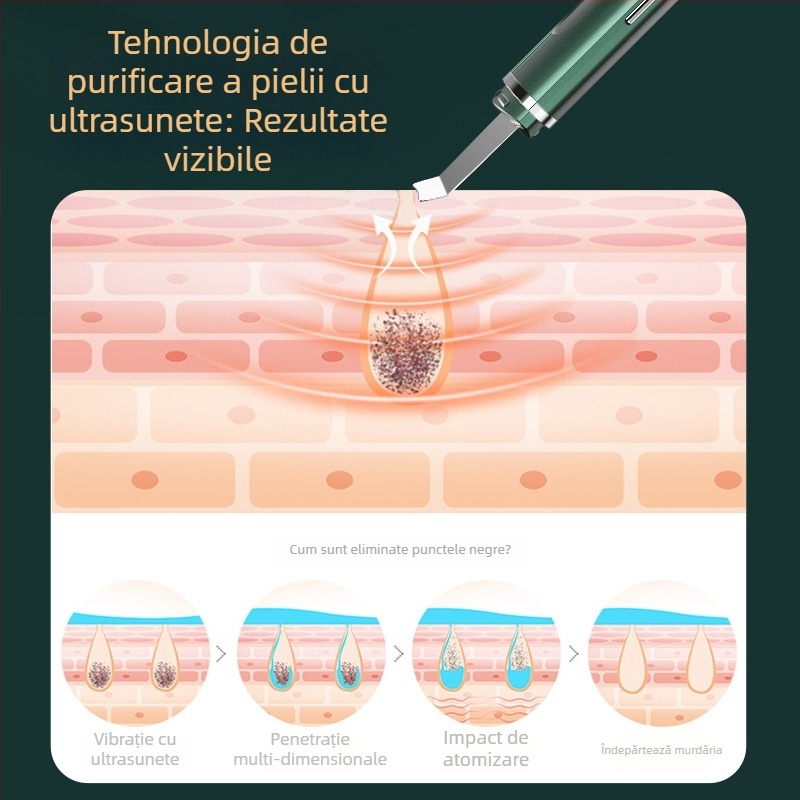 Dispozitiv de îngrijire a pielii cu ultrasunete pentru îndepărtarea punctelor negre și introducere de ioni, model C62, curent EMS micro, 3 trepte de reglaj, carcasă ABS