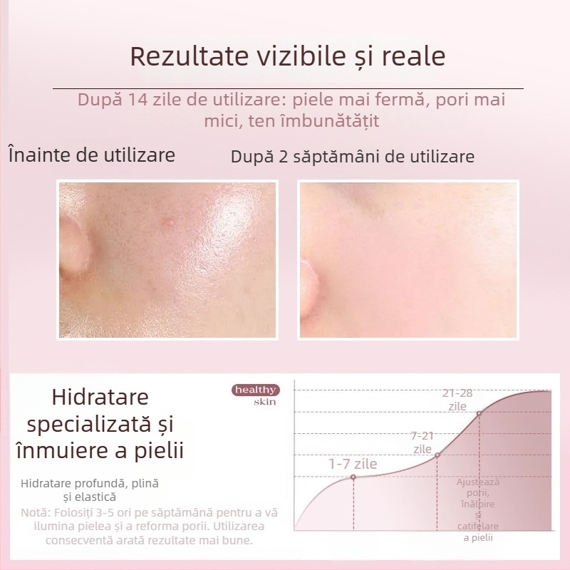 Aparat de aburi fața cu abur cald, 5 trepte, baterie încorporată 1200-2000mAh, timp de ceață peste 180 de secunde
