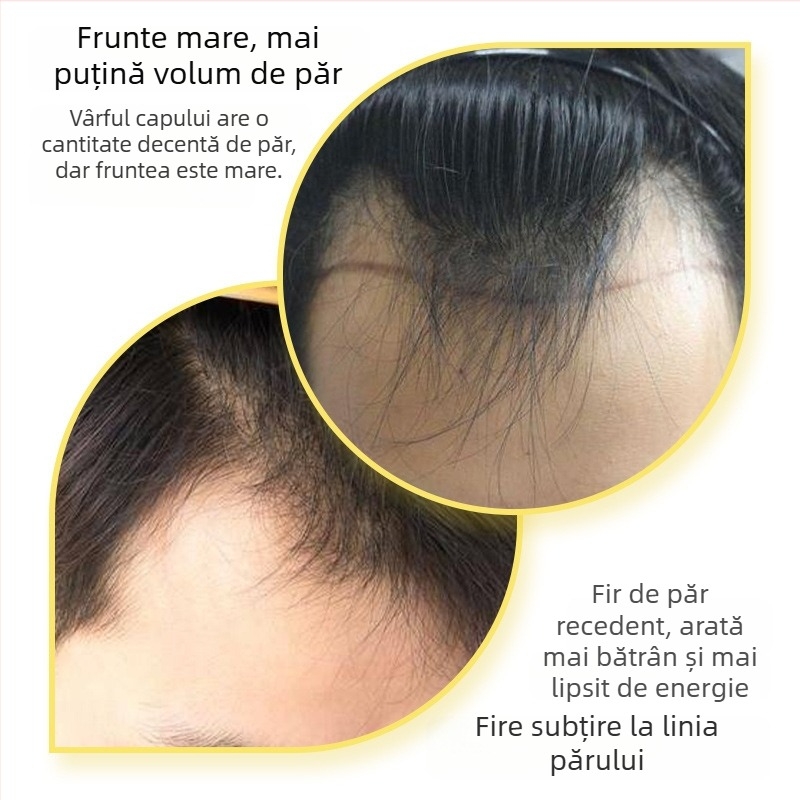 Patch de păr cu linie de păr în formă de M pentru bărbați și femei, țesut manual, păr uman, drept, poate fi vopsit sau tratat cu perm