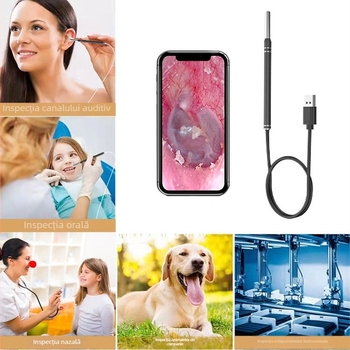 Endoscop auditiv cu vizualizare HD inteligentă, set cu lingurițe pentru urechi, mărire